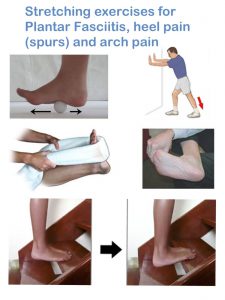 Heel Pain / Heel Spur – Treatment - Kilkenny Physiotherapy Clinic-thanhphatduhoc.com.vn