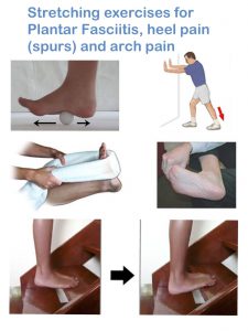 Exercise for spur in heels sale