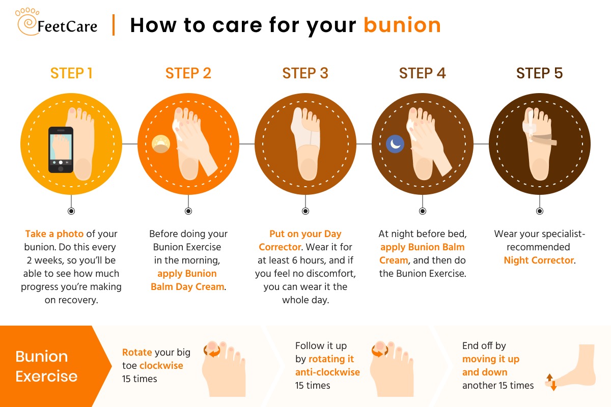 infographic illustrating how to care for your bunion