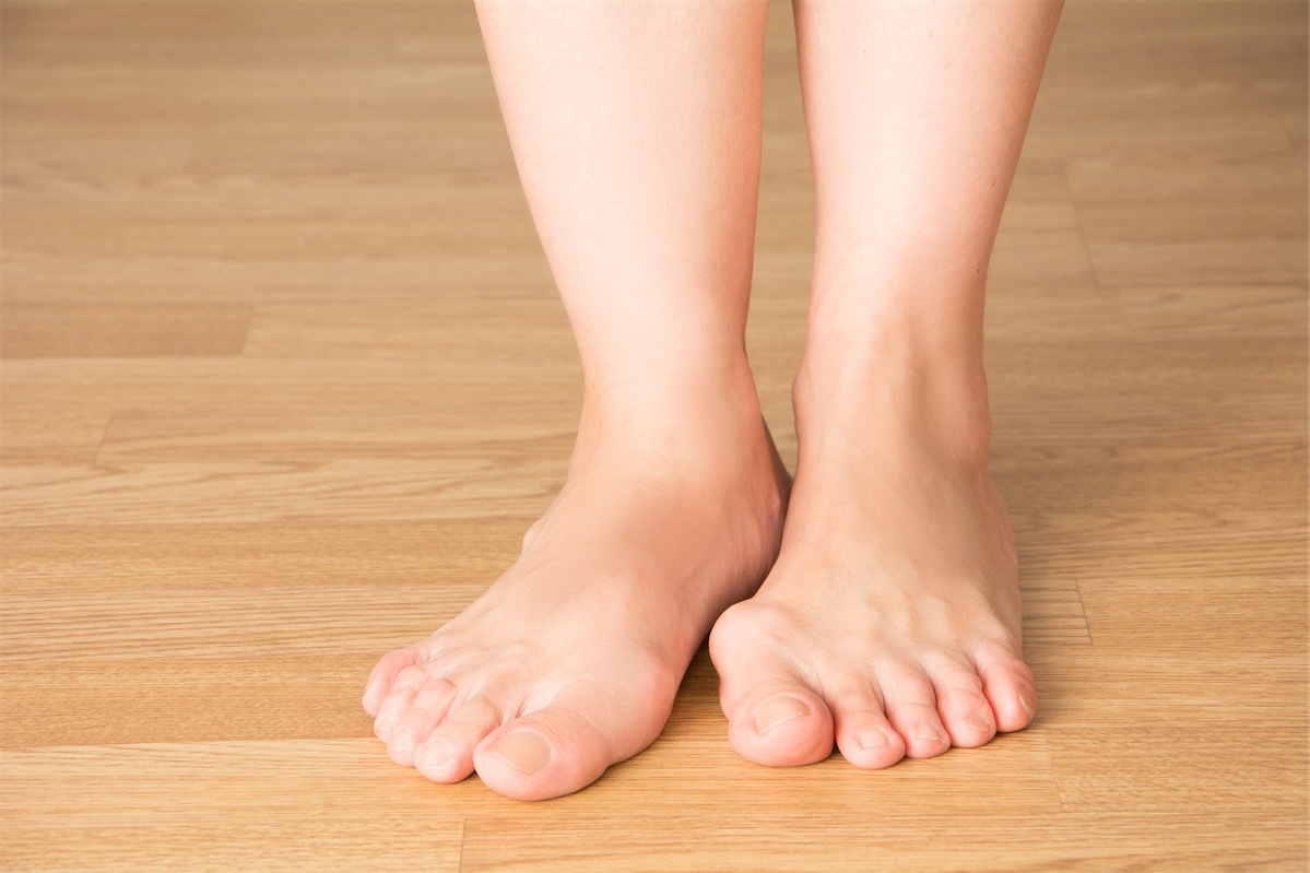 feet of individual with a bunion on left foot